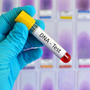 DNA Testing – Definition, Types, and Procedure