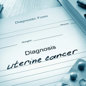 Uterine Cancer – Its Causes, Symptoms, and Stages