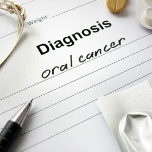Oral Cancer – Symptoms, Causes and Management Options