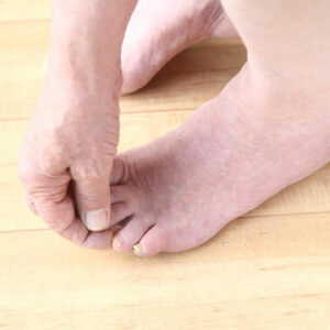 Fibromyalgia Foot Pain – Factors to Understand