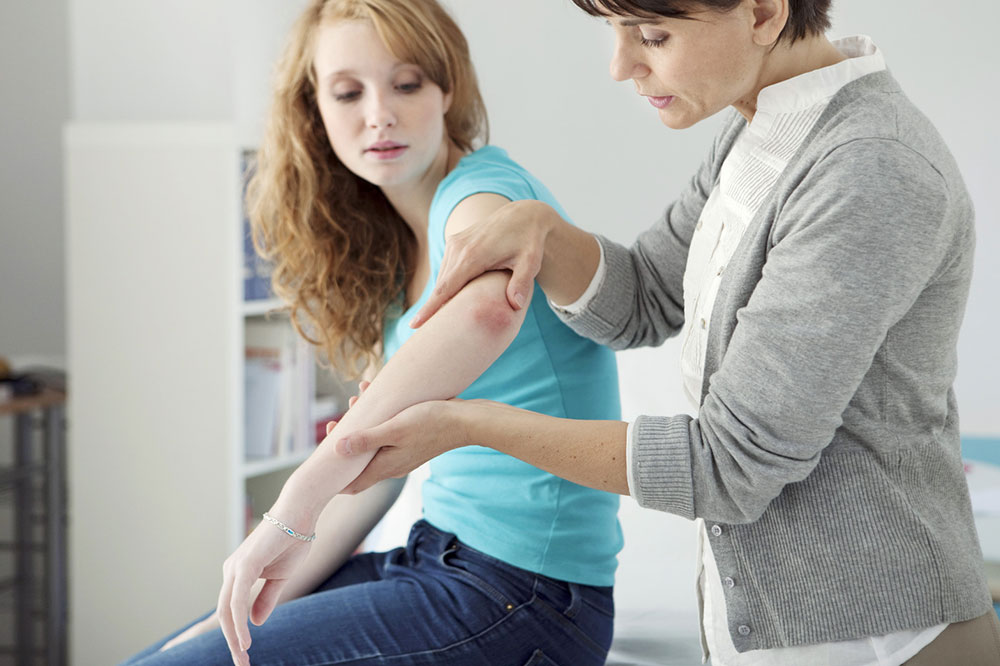 Psoriasis – symptoms, causes, and treatment options