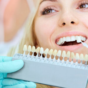 Dental Implants – Procedure and Cost